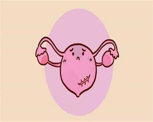 滁州代孕2020：患了卵巢癌能治愈好吗？